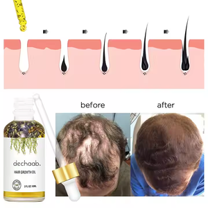Dechaab produk pertumbuhan rambut cepat Serum pertumbuhan rambut botak minyak jarak alami Rosemary pertumbuhan rambut untuk pria - Product Image 6