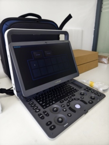 Système d'échographie Doppler couleur portable de diagnostic Sonoscape E1EXPV de qualité supérieure pour les hôpitaux et les cliniques - Product Image 4