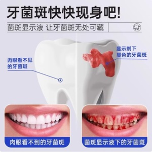 แผ่นตรวจสอบคราบพลัคพร้อมแท่งตรวจจับสีสำหรับตรวจสุขภาพฟันด้วยตนเองที่บ้าน - Product Image 4