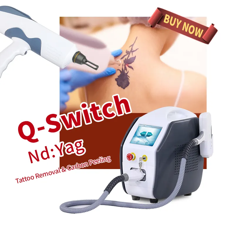 Máquina de remoção de tatuagem de alta frequência, 1064 nm 532nm e 1320nm q switch nd yag, máquina de remoção de tatuagem a laser