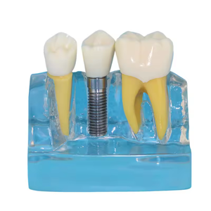 Medische Wetenschappelijke Lesapparatuur Leermodellen Tandheelkundige Typodont Menselijke Tanden Modelpraktijk Tandheelkundig Implantaatmodel - Product Image 2