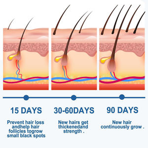 Creme de Ervas Personalizado OEM para Recrescimento Capilar e Sérum para Cuidado do Couro Cabeludo com Função Reparadora - Product Image 4