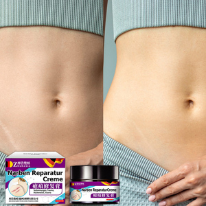 ครีมกำจัดรอยแผลเป็น-รอยแผลเป็นตามธรรมชาติและครีมบำรุงแผลสำหรับการใช้งานภายนอกที่กำหนดเอง - Product Image 5