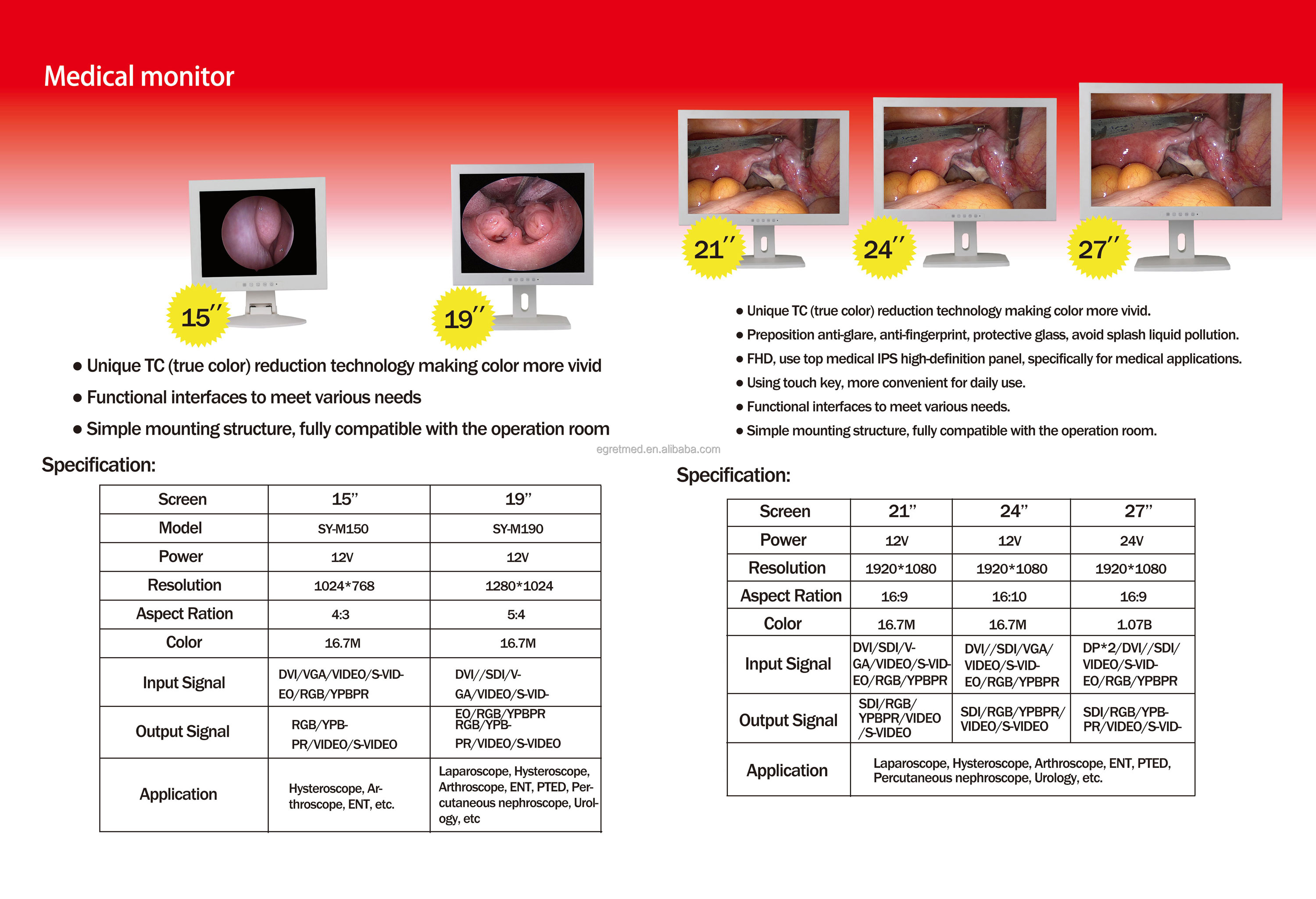 Conjunto completo de cistoscopio de urología para uso hospitalario