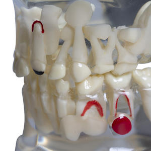 Modelo de Dientes Permanentes Primarios para Pacientes Dentales Pediátricos, Cristal Transparente, Herramienta de Comunicación Médico-Paciente, Ciencia Médica - Product Image 1