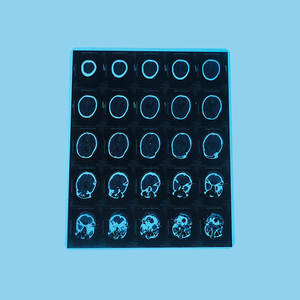 Termal medikal Film X ışını CT CR <span class=keywords><strong>DR</strong></span> MTR Fuji kuru Pix 3500 Fuji Film termal medikal Film - Product Image 6