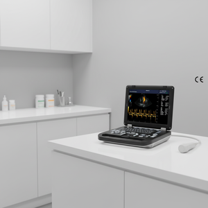 Perangkat Pencitraan Medis Resolusi Tinggi <span class=keywords><strong>Laptop</strong></span> 3D Paling Populer Mesin <span class=keywords><strong>Ultrasound</strong></span> Doppler Warna PW - Product Image 1