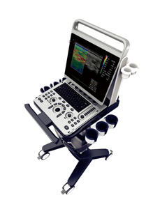 Chison Ebit50 draagbare echografiemachine Kleuren <span class=keywords><strong>Doppler</strong></span> voor OB&GYN, hartmeting met twee probes - Product Image 2