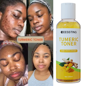 โทนเนอร์ขมิ้นสมุนไพรธรรมชาติลดจุดด่างดำทำให้สีผิวจางลงโทนเนอร์สำหรับใบหน้า - Product Image 1