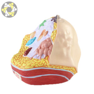 Modèle anatomique du <span class=keywords><strong>cancer</strong></span> du sein féminin dans la section transversale modèle de médecine du sein pathologique - Product Image 2