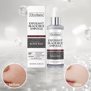 Agente de Compras 1688: Exfoliante Facial Suave de Arroz Blanco OEM/ODM para Eliminar Células Muertas de la Piel - Product Image 5