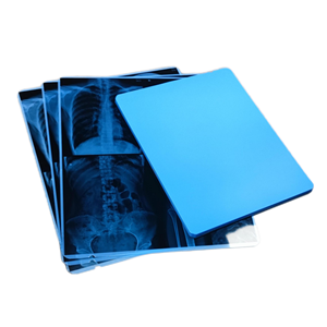 Film radiographique bleu à jet d'encre 10x12 pouces, vente chaude, film médical à base de PET pour le service de <span class=keywords><strong>radiologie</strong></span> hospitalier - Product Image 2