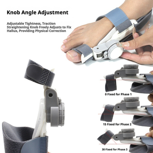 Correcteur orthopédique ajustable pour <span class=keywords><strong>hallux</strong></span> <span class=keywords><strong>valgus</strong></span> avec bouton rotatif, attelle de nuit flexible, semelles intérieures confortables pour le sport - Product Image 4