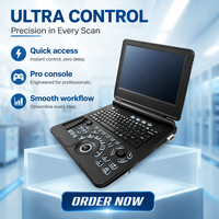 Vente en gros - Promotion exceptionnelle : Échographe Doppler Couleur Portable avec options de sondes Convexe et Linéaire pour usage Commercial et Domestique