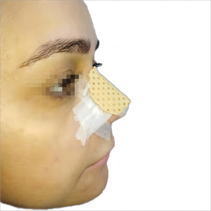 Férula termoplástica nasal <span class=keywords><strong>Aquaplast</strong></span> para cirugía plástica de nariz, rinoplastia, fijación de rehabilitación de fracturas - Product Image 3