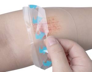 저 알레르기 멸균 인공 피부 드레싱 대형 하이드로 콜로이드 상처 드레싱 패치 바디 패치 - Product Image 2