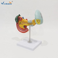 Modelo de Simulación de Enfermedades Biliares y del Páncreas con Cálculos Biliares y Tumor de Pancreatitis para Entrenamiento Médico, con Certificaciones CE/ISO/ROHS/CNAS