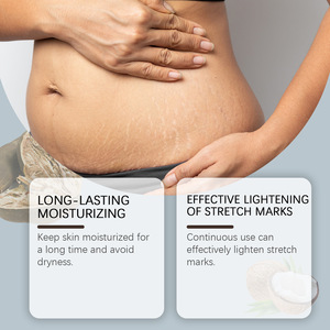 OUHOE Crème Éclaircissante et Réparatrice Anti-Vergetures, Meilleure Crème Peeling Contre les Vergetures - Product Image 2