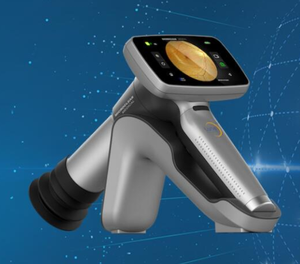 Attrezzatura Oftalmica, Fotocamera Digitale per Retina, Fotocamera Portatile per <span class=keywords><strong>Fondo</strong></span> Oculare per Ospedali Veterinari - Product Image 5