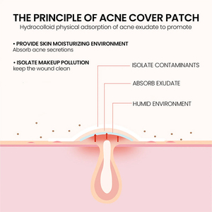Parche Impermeable Personalizado para el Acné con Aloe Vera, Colágeno y Vitamina C - Hidrocoloide Hidratante para la Curación del Acné Facial - Product Image 5