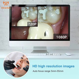 PAKISS telecamera intraorale dentale portatile di alta qualità Fy-B800 all'ingrosso personalizzata con Monitor - Product Image 5