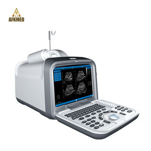 Mesin Pemindai Medis Ultrasound, Mesin Pemindai Medis Ultrasound Portabel Kucing 3d - Product Image 3