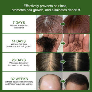 น้ำมันบำรุงผมสมุนไพรวีแกน สำหรับ<span class=keywords><strong>ผม</strong></span>เสีย บำรุงและเพิ่มความชุ่มชื้น ด้วยส่วนผสมของโรสแมรี่และน้ำมันเมล็ดฟักทอง - Product Image 2