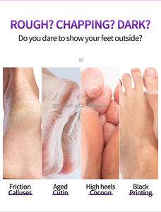 Prodotti unici per la vendita di prodotti unici per la vendita all'ingrosso bambino piede maschera esfoliante piedi lungo maschera spa pedicure calzini - Product Image 2