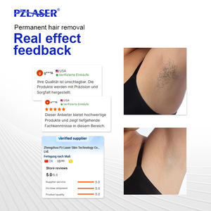 PZLASER 2026 최신 4파장 다이오드 레이저 제모기 Eos 아이스 고정형 레이저 제모기 AI 피부 분석 기능 포함 - Product Image 6