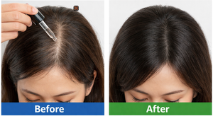 Kit <span class=keywords><strong>de</strong></span> Microneedling con Suero <span class=keywords><strong>para</strong></span> <span class=keywords><strong>el</strong></span> Cuidado del <span class=keywords><strong>Cabello</strong></span> <span class=keywords><strong>de</strong></span> 5ml con Extracto <span class=keywords><strong>de</strong></span> Salmón, Sistema <span class=keywords><strong>de</strong></span> Microinfusión Nutritiva <span class=keywords><strong>para</strong></span> <span class=keywords><strong>el</strong></span> Cuero Cabelludo - Product Image 4