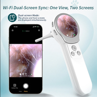 Otoscope Meiboyi avec écran HD, caméra endoscopique avec 2 millions de pixels pour l'examen des oreilles et de la gorge des animaux, otoscope numérique pour la gorge