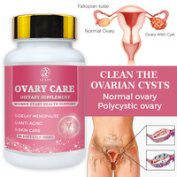 Capsules de soutien ovarien pour femmes OEM/ODM – Complément alimentaire à base de plantes pour la santé reproductive – Capsules molles pour le soin des ovaires