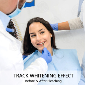 दंत दांत Whitening विरंजन छाया गाइड - Product Image 4