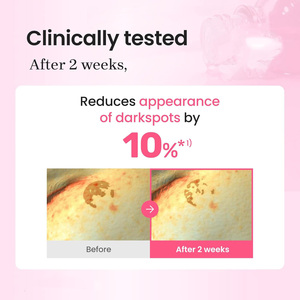 프라이빗 라벨 스킨케어 PDRN 트라넥삼산 세럼 15% 핑크 토닝 스킨 부스터 나이아신아마이드 & 마이크로 스피큘 글래스 스킨용 - Product Image 4