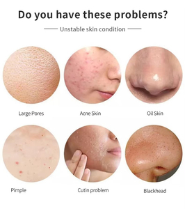 Esencia Facial Orgánica de Marca Privada con Extracto de Caracol, Reafirmante e Hidratante, Esencia Blanqueadora con Ácido Hialurónico para el Cuidado de la Piel - Product Image 4