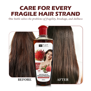 Сыворотка-масло для волос с касторовым маслом для глубокого увлажнения и восстановления, разглаживающая, нежирная, с богатой нежной формулой для поврежденных волос, с рицинолеевой кислотой - Product Image 6