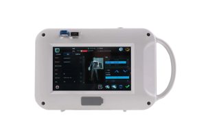 Mobil dijital radyografi <span class=keywords><strong>MINI</strong></span> el <span class=keywords><strong>x</strong></span>-<span class=keywords><strong>ray</strong></span> cihazı - Product Image 4