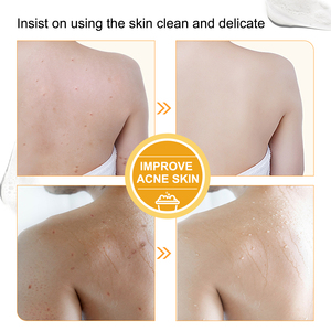 Làm Sáng Kojic Axit Xà Phòng Ban Đầu Làm Trắng Da Xà Phòng Làm Bằng Tay Kojic Axit Xà Phòng Cho Làm Giảm Sự Xuất hiện của Mụn Trứng Cá Sẹo - Product Image 6