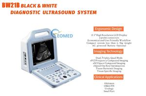 Grosir Rumah Sakit 12.1 inci penggunaan manusia dokter hewan Laptop B & W mesin pemindai <span class=keywords><strong>Ultrasound</strong></span> perangkat Echographie - Product Image 2
