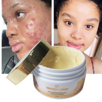 Crème de soin de la peau anti-âge de haute qualité, naturelle, pour éliminer les taches noires, à la vitamine C, blanchissante, au curcuma, hydratante pour le visage