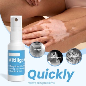 Traitement du <span class=keywords><strong>vitiligo</strong></span> à base de plantes 30ml Vente en gros Soins de la peau Spray dissolvant de taches blanches - Product Image 2