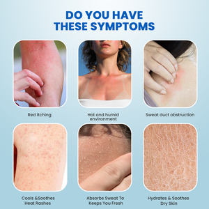 Sumifun Private Label <span class=keywords><strong>Prickly</strong></span> <span class=keywords><strong>Heat</strong></span> Powder Spray Rinfrescante per Pelle Secca con Vitamine e Ingredienti Erboristici per la Cura della Salute e Funzione Antidolorifica - Product Image 4