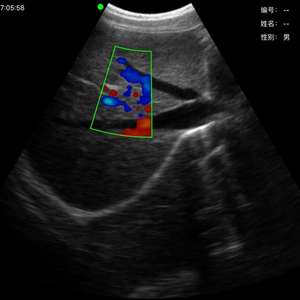Ecógrafo Veterinario Inalámbrico Doppler Convexo Lineal Portátil <span class=keywords><strong>de</strong></span> Doble Cabezal y 128 Elementos para Uso Médico - Product Image 4