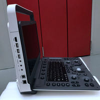 Sonoscape E2 Máquina de ultrasonido portátil 15,6 "HD Color Doppler Ultrasonido médico para clínica veterinaria humana o equipo de hospital