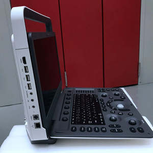 Sonoscape E2 Draagbare Echografie Machine 15.6 "Hd Color Doppler Medische Echografie Voor Menselijke Dierenkliniek Of Ziekenhuisapparatuur - Product Image 2