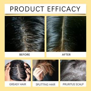 Hot bán thực vật tự nhiên chiết xuất từ rễ tóc dầu gội đầu nuôi dưỡng sâu sắc, lâu dài sức sống Keratin dầu gội đầu - Product Image 4