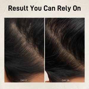 <span class=keywords><strong>Shampoo</strong></span> di bilanciamento del cuoio capelluto <span class=keywords><strong>neutro</strong></span> <span class=keywords><strong>Ph</strong></span> 300ml <span class=keywords><strong>Shampoo</strong></span> antiforfora - Product Image 5