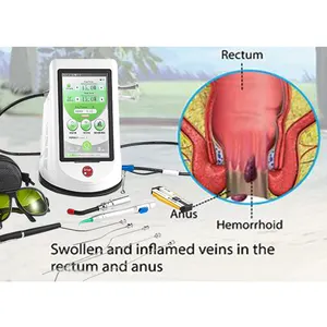 New popular 1470nm diode laser equipment for Hemorrhoids & Fistula surgery treatment