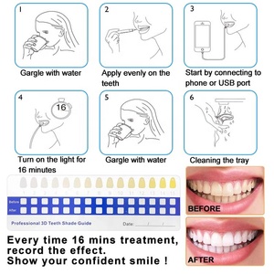 Home Sử Dụng Tùy Chỉnh Điện Thoại Di Động Led Ánh Sáng Tự Nhiên Sensitivsle Miễn Phí Nhãn Hiệu Riêng Logo Răng Nhanh Làm Trắng Bộ Dụng Cụ Bút - Product Image 6