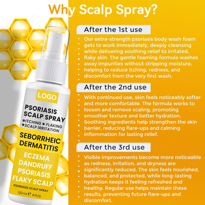 Spray capillaire 2-en-1 OEM à marque privée, à base de plantes, pour le psoriasis et le cuir chevelu, anti-pelliculaire, antibactérien, soulagement des démangeaisons, pour la <span class=keywords><strong>dermatite</strong></span> séborrhéique - Product Image 6